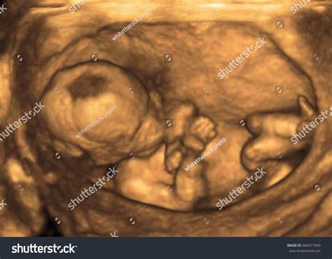 Ultrasound 3d Stock Photo 466677959 : Shutterstock