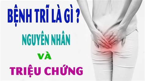 Bệnh Trĩ Là Gì Nguyên Nhân Và Triệu Chứng Của Bệnh Trĩ - YouTube