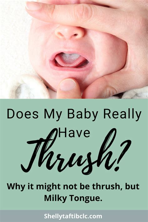 Does My Baby Have Thrush? (Thrush Vs Milky Tongue) - Shelly Taft