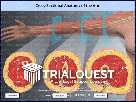 Cross-Sectional Anatomy of the Arm - TrialQuest Inc.