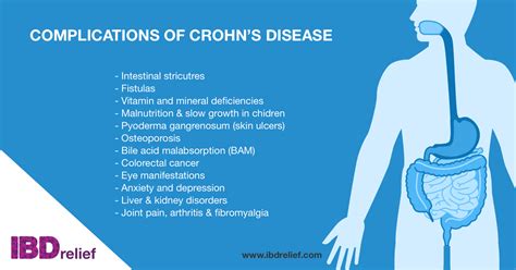 Complications of Crohn's disease | IBDrelief