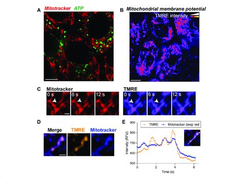 Live imaging of ATP and mitochondrial membrane potential demonstrates... | Download Scientific ...