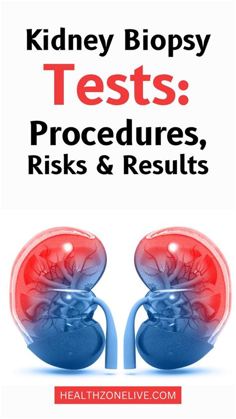 Kidney Biopsy Tests: Procedures, Risks & Results | Kidney biopsy, Kidney friendly recipes renal ...