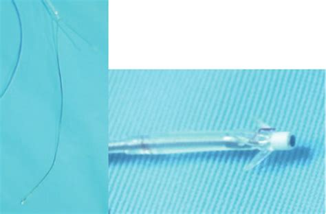 Pacemaker Lead after extracted. | Download Scientific Diagram