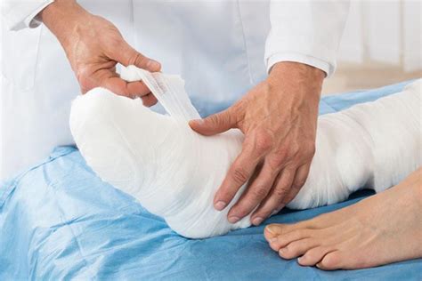 Treatment Methods for Broken Bones: NASA Bone & Joint Specialists: Orthopedic Sports Medicine ...