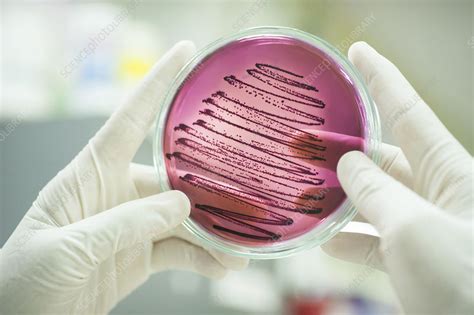 Bacterial culture - Stock Image - F032/3256 - Science Photo Library