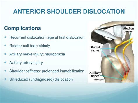 PPT - Acute Joint Dislocation PowerPoint Presentation, free download ...