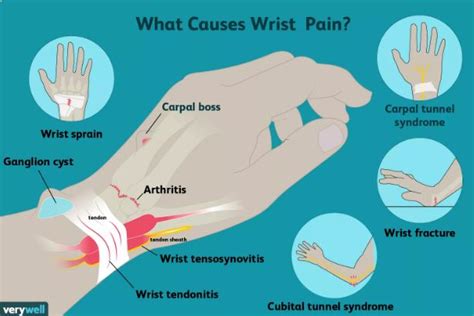 Finger Joints Clicking, Snapping and Popping – Dr George El Rassi