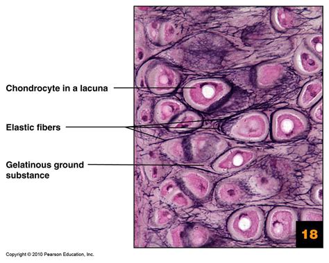 Elastic Cartilage Histology