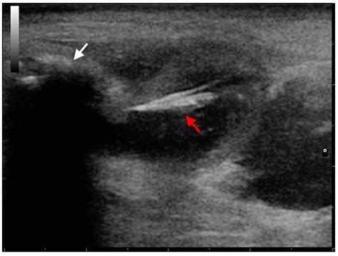 Animals | Free Full-Text | Application of Ultrasound in Detecting and ...