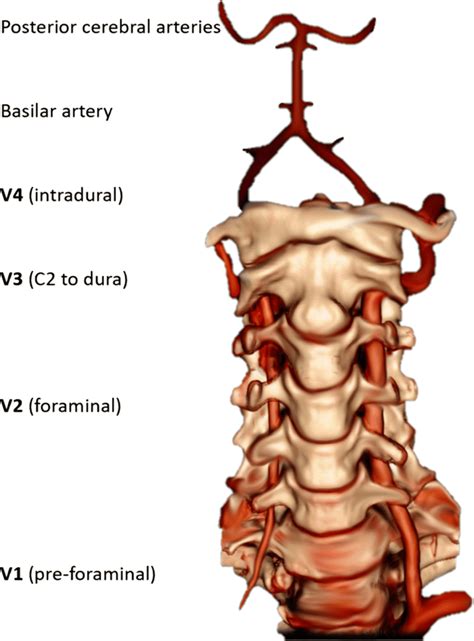 Vertebral Artery