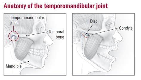 TMJ (Temporomandibular Joint and Muscle Disorders) | The Dental Arcade – Blog