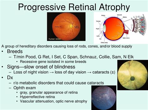 PPT - Ophthalmic Diseases PowerPoint Presentation - ID:998440