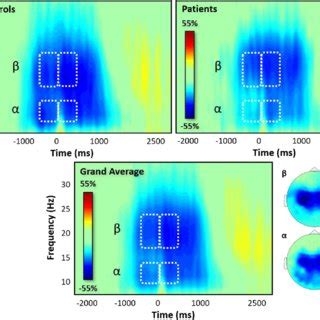 Sensor-level spectrograms and topographic maps. Spectrograms from a MEG... | Download Scientific ...