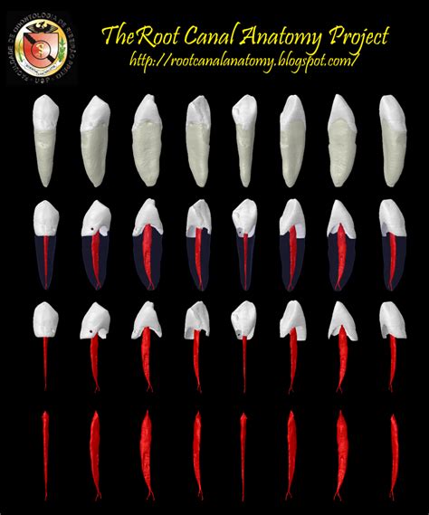 The Root Canal Anatomy Project: Mandibular Canine