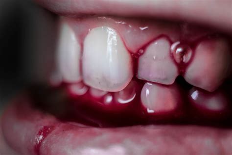 Conversations With a Mouth | Unsettling Stories