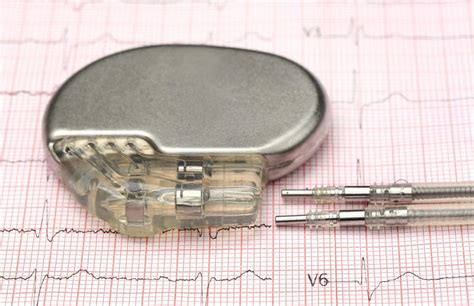 Medical device in-depth product overview: Pacemaker leads