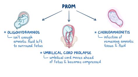 Intrapartum Complications - Osmosis Video Library