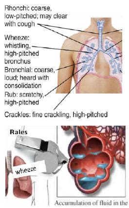 Respiratory sounds