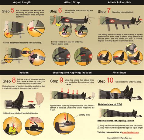 Applying a traction splint | Emt study, Volunteer emt, Emt