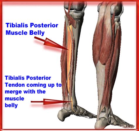 Plantar Fasciitis or Tibialis Posterior Tendonitis?!? | Tendinitis ...