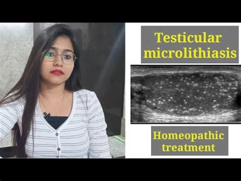 Testicular microlithiasis homeopathic treatment!Testicular ...