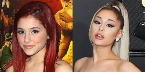 Ariana Grande's Face: Before and After Plastic Surgery