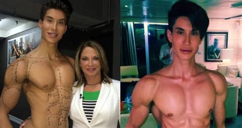 Justin Jedlica, The Man Who Turned Himself Into The 'Human Ken Doll'