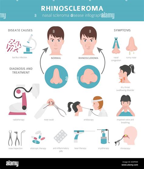 Nasal diseases. Rhinoscleroma symptoms, nasal scleroma treatment icon set. Medical infographic ...