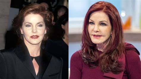 Priscilla Presley's Plastic Surgery: The Actress Had Botched Botox Treatment; Look at The Before ...