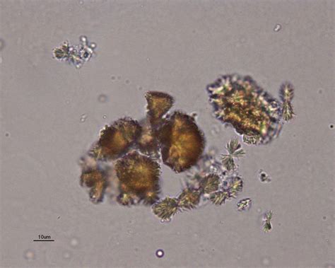 Urine crystals | eClinpath