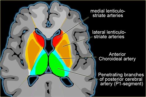 The Radiology Assistant : Brain Ischemia - Vascular territories | Basal ganglia, Basal ganglia ...