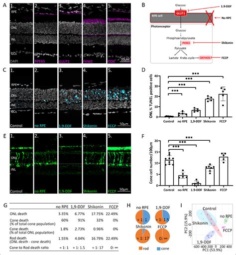 Figure 1 from Retinal metabolism displays evidence for uncoupling of ...