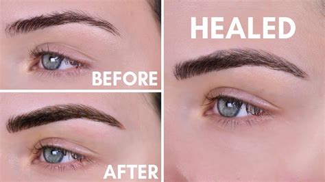 Microblading Experience Before After 10 Day Healing Process