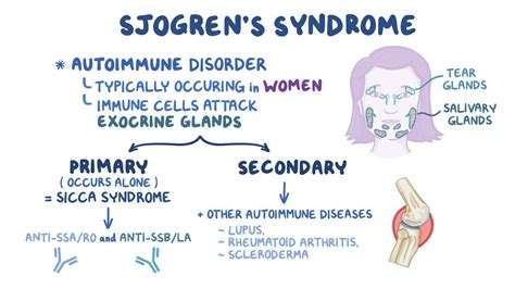 Sjogren syndrome: Clinical - Osmosis Video Library