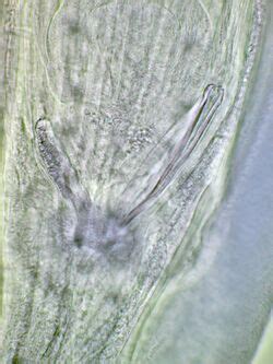 Biology:Gubernaculum (nematode anatomy) - HandWiki