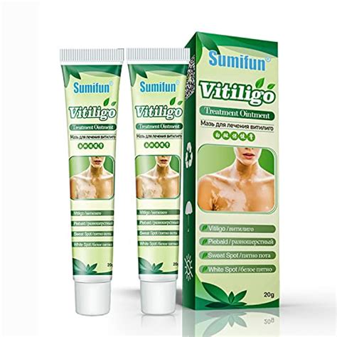 Best Vitiligo Treatment Cream On The Market Today - Spicer Castle