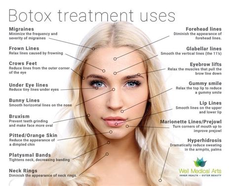 Botox® is a brand name of an FDA-approved injection which is made of a ...