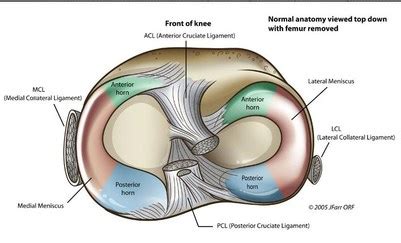 Rotura de menisco, tratamiento y recuperacion - DR BALLESTER- TRAUMATOLOGIA CIRUGIA ORTOPEDICA