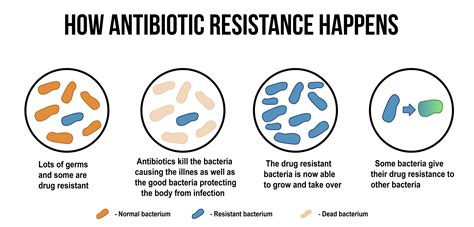 Silent Pandemic – Antibiotic Resistance - JASE Medical