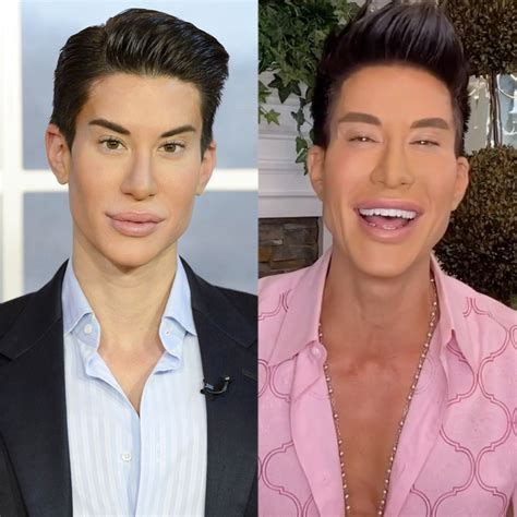 Botched: Human Ken Doll Is Back! Hear About His 900+ Surgeries - E ...