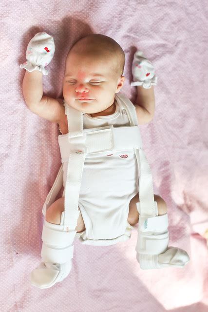 Difference between Pavlik Harness and Rhino Harness? | BabyCenter