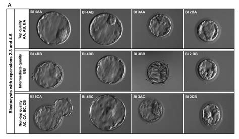 Embryo Grading - Quality Chart and IVF Success Rates