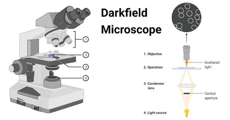 Darkfield Microscope- Definition, Principle, Uses, Diagram