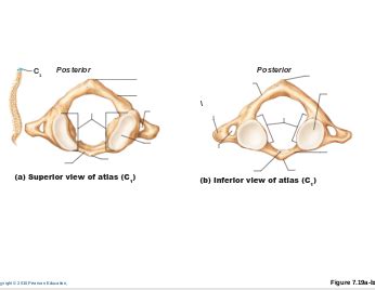 anatomy - superior & inferior view of atlas Diagram | Quizlet