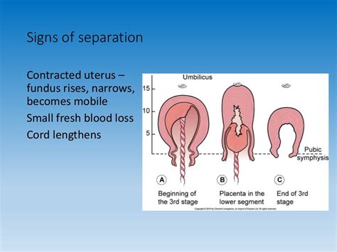 Third stage of labour