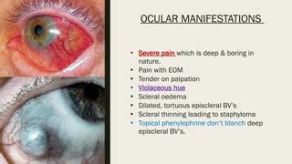 Episcleritis & Scleritis (causes, clinical features, treatment).pptx