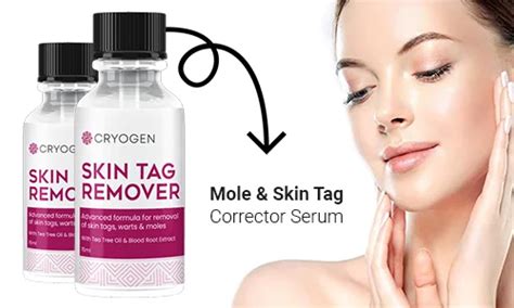 In 5 Best Skin Tag Remover -Cryogen Skin Tag Remover Reviews