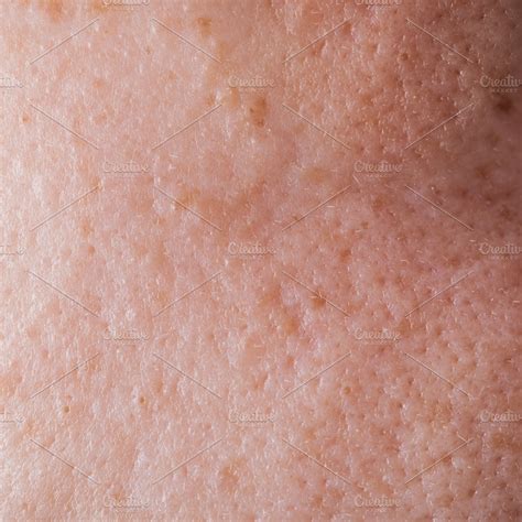 Human face skin texture stock photo containing abstract and acne | People Images ~ Creative Market