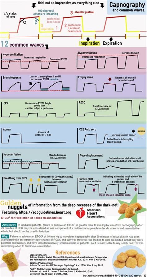 end tidal co2 waveforms - We Had A Big History Image Database